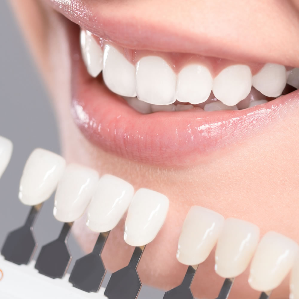 white-smiles22